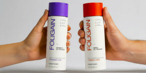 Mor ve turuncu kapaklı, kadınlar ve erkekler için FOLIGAIN TRIOXIDIL saç kremlerini tutan eller.